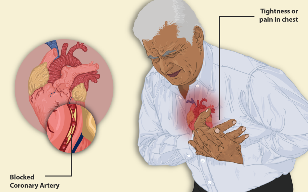February Is Heart Health Awareness Month