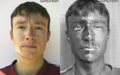 July is UV Radiation Awareness Month