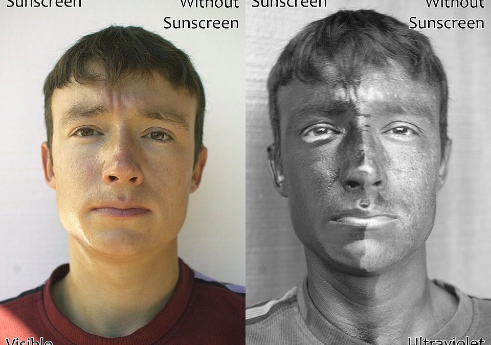 July is UV Radiation Awareness Month